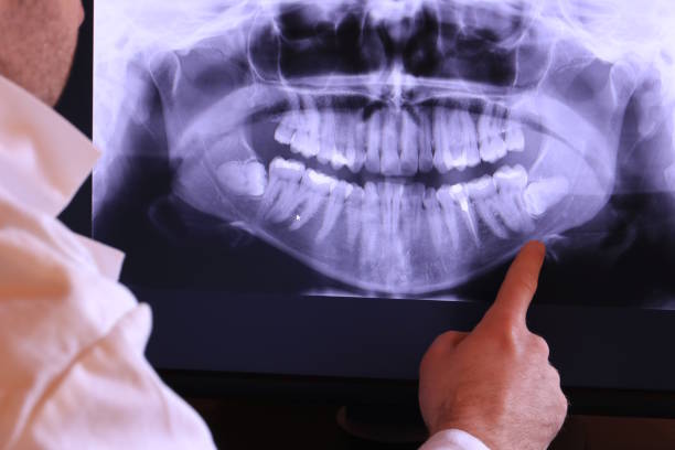 Best Emergency Gum Treatment in Trumansburg, NY