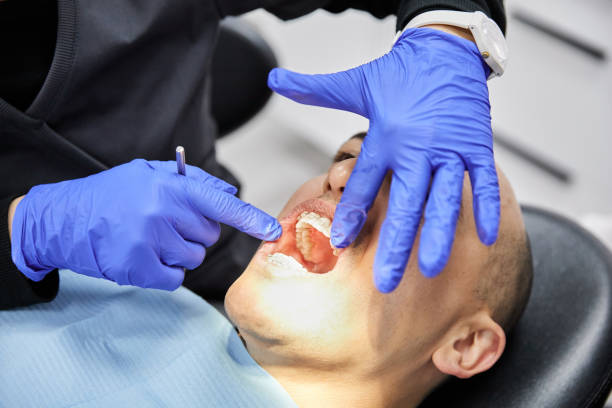 Best Emergency Root Canal Treatment in Trumansburg, NY